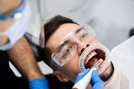 Airflow teeth cleaning process. Dentist removes plaque from teeth with airflow equipment. Dental hygiene procedure.