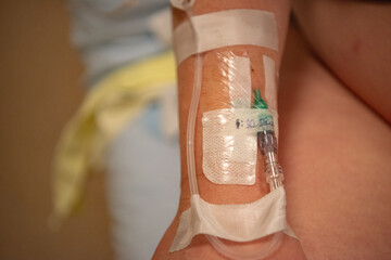 IV drip in a patient's arm