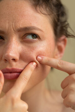 Skin care