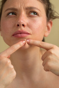 Popping pimple
