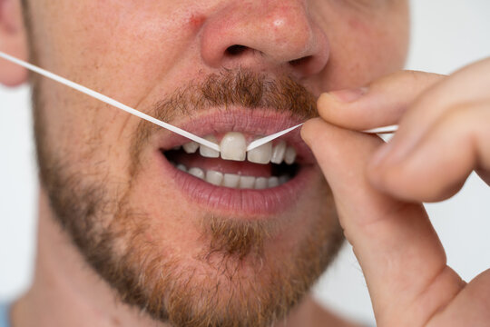 Floss teeth