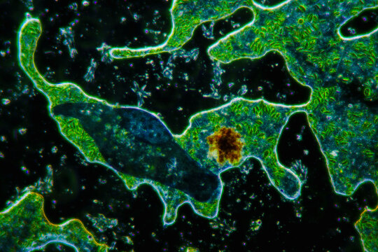 green algae and aquatic organisms in water