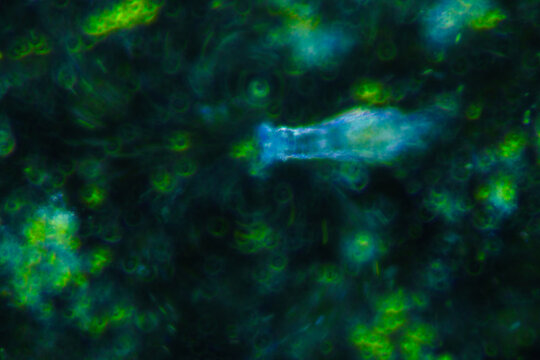 Aquatic organisms sucking green algae in water