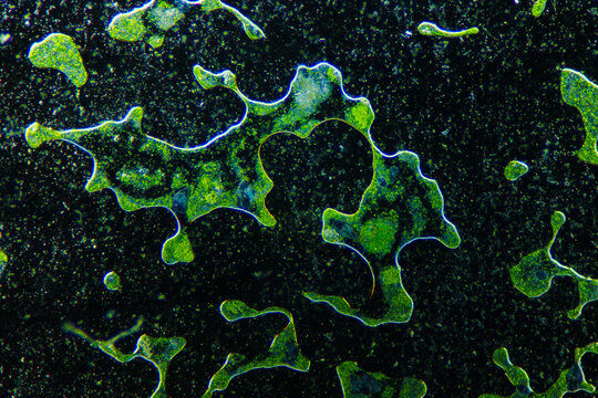 green algae and aquatic organisms in water