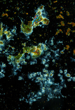 Vitamin B2 crystals under a microscope