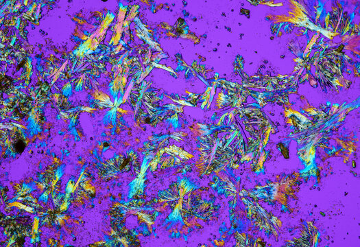 Vitamin B2 crystals under a microscope