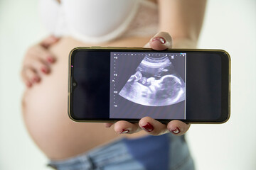 Woman showing ultrasound of her baby on her cell phone