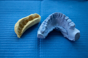 Dental impressions