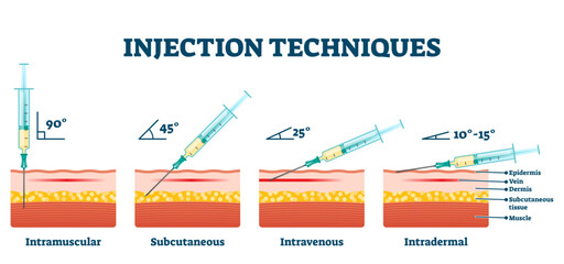 Injection techniques illustration, transparent background.Labeled educational medical procedure examples scheme.Various methods of needle jab in skin.