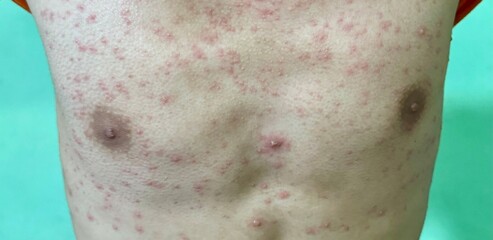 close up of a person with a bandage