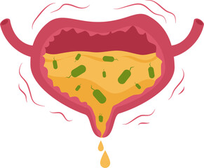 Urinary bladder disease. Urinary tract infection Illustration.