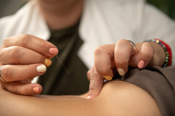 Acupuncture for Ischialgia Back Pain