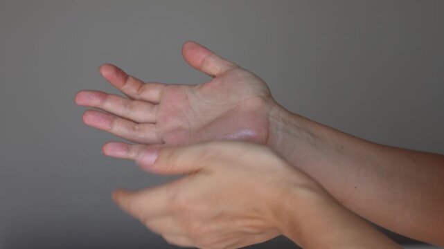 The problem of hyperteriosis. Young woman touching her sweaty palms on a grey background. Сlose-up of clammy female hands. Hyperhidrosis, Increased sweating of the hands