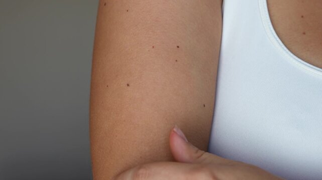 A cropped shot of a young woman running her hand over her arm touching goosebumps on her skin on a grey background