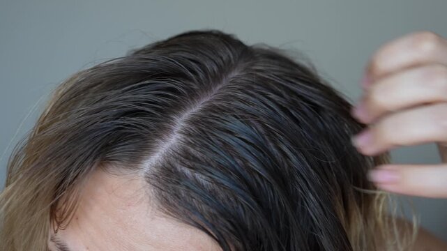 Young blonde woman applying essential cosmetic burdock oil rubbing it into the scalp with hand to strengthen, activate hair growth and reduce hair loss on a dark grey background