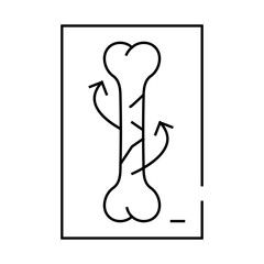 spiral fracture line icon vector. spiral fracture sign. isolated contour symbol black illustration