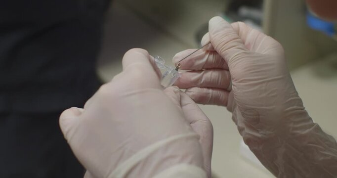 The doctor's gloved hands place a piece of biopsy into a jar of formalin. During the endoscopic examination, the doctor takes a tissue sample for histological examination.