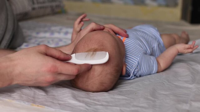 Father with comb in his hand gentle removing cradle cap of seborrheic dermatitis of baby's head.