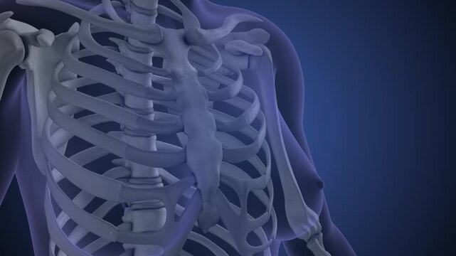 Chronic sternum pain syndrome animation