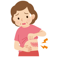 帯状疱疹ができて痛みがある中年女性　症状