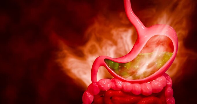 Symptoms of acid reflux or excess acid in the stomach. Gastric juice and intestinal model within the abdominal cavity. Burning sensation in the middle of the chest, acid reflux. 3D Rendering.