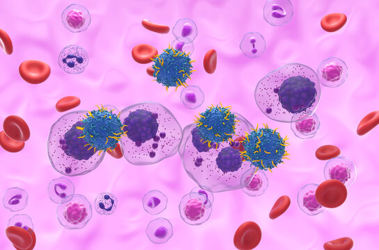 CAR T cell therapy in Multiple myeloma (MM) - isometric view 3d illustration