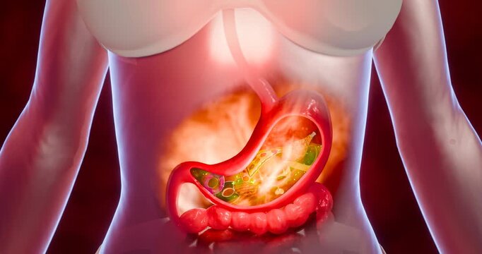 Symptoms of acid reflux or excess acid in the stomach. Gastric juice and intestinal model within the abdominal cavity. Burning sensation in the middle of the chest, acid reflux. 3D Rendering.