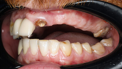 missing half of the teeth in the upper jaw of a young man before implantation © Dental Pro Content