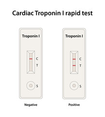 Cardiac Troponin I rapid test