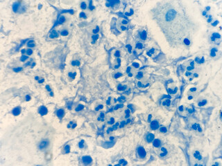 White blood cell.