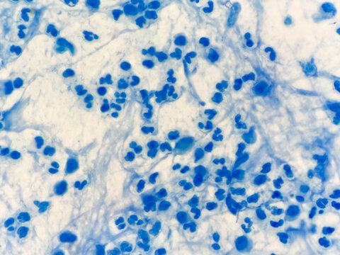 White blood cell.