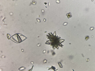 Uric acid crystal in urine sediment.