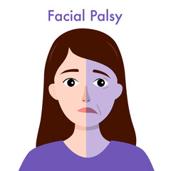 Facial palsy. Male character with asymmetrical face, nerve damage. Drooping smile.