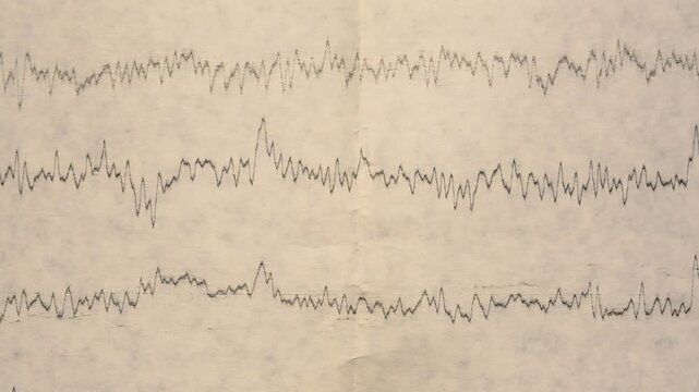 Seismograph Record of an Earthquake on old paper, EEG of the patients problems in the electrical activity of the brain