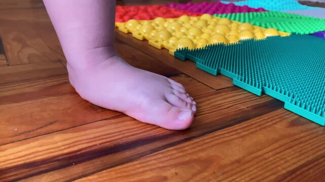 The child walks with his feet on orthopedic mats. Valgus foot in a child. Orthopedist