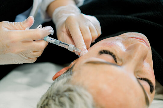 Cosmetic facial treatment with dermal fillers in clinic