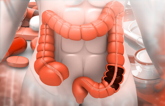 Human colon anatomy on medical background. 3d illustration..