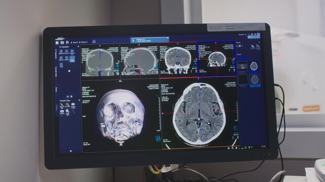 No people shot of CT or MRI scanner screen demonstrating digital brain magnetic resonance image in diagnostic centre