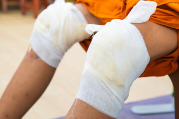 Knee pain relief with herbal. Knee osteoarthritis. Thai traditional medicine