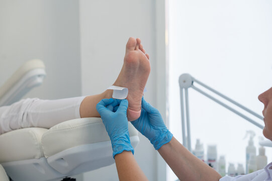 A podologist wearing gloves glues a special relief corn patch on the heel of the patient. Patient on medical pedicure procedure, visiting podiatrist. Peeling feet. Foot treatment in SPA salon.Podiatry