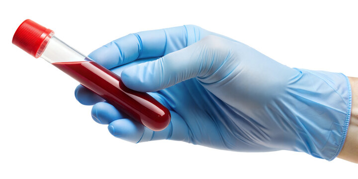 Hand holding blood sample in a test tube for medical examination isolated on transparent background