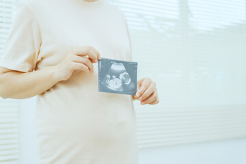 A middle-aged pregnant Asian woman is isolated on a white background, highlighting her maternity...