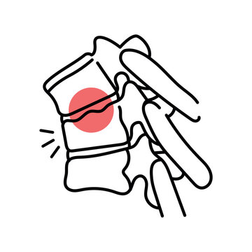 Scheuermann kyphosis disease color line icon. Diseases of the spine