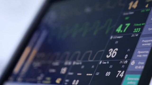 Extreme close up of a monitor of lung ventilating machine showing the life signs of a patient. Surgery room equipment in blur.