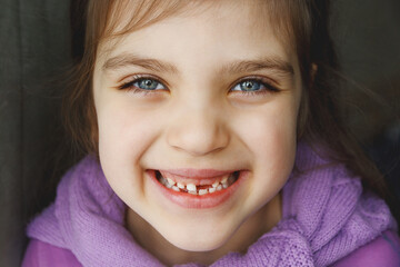 Funny girl 6 years old without one front top tooth at home
