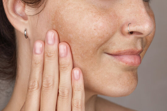 Cropped photo of caucasian woman's face with freckles or age spots photo. She loves her skin close up
