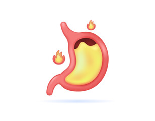 stomach acid rising. hot stomach or heartburn. GERD. illustration of the stomach organ and fire. health problems. symbol or icon. minimalist 3d style design. graphic elements
