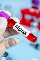 Obraz premium Blood collection tubes monkeypox test positive results,WHO to rename monkeypox as ‘MPOX’,vertical