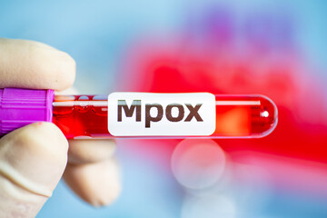 Blood collection tubes monkeypox test positive results,WHO to rename monkeypox as ‘MPOX’	