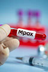 Obraz premium Blood collection tubes monkeypox test positive results,WHO to rename monkeypox as ‘MPOX’,vertical
